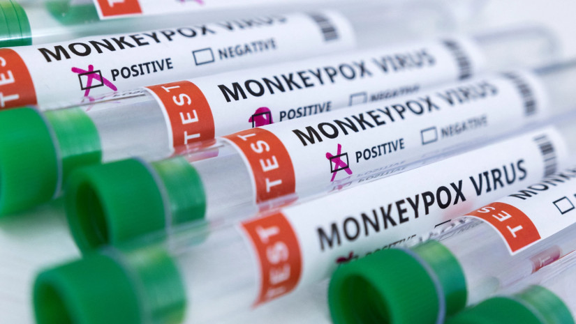 Monkeypox Monkeypox