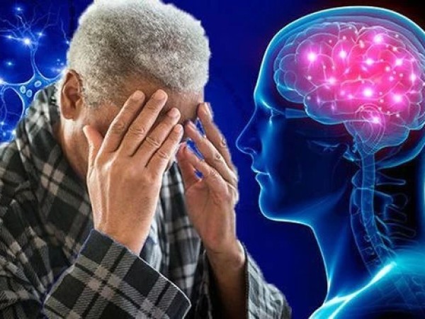 დემენცია