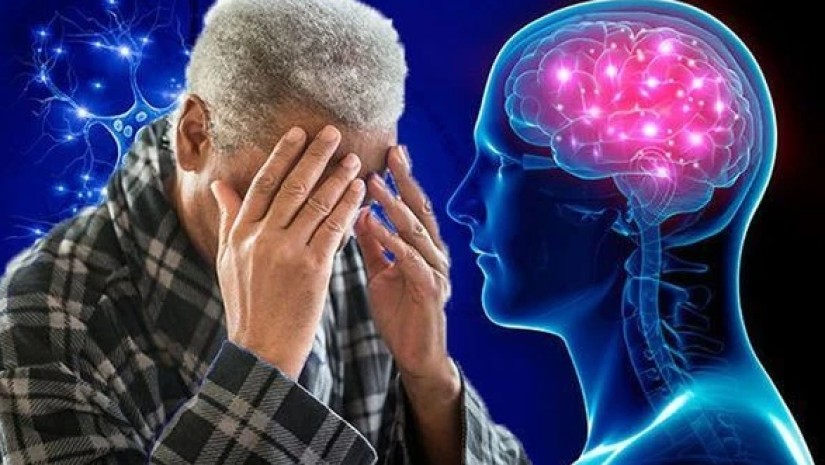 დემენცია