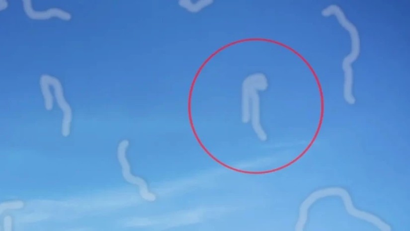https://www.iflscience.com/just-what-are-those-weird-floating-things-you-sometimes-see-in-your-vision-66826 https://www.iflscience.com/just-what-are-those-weird-floating-things-you-sometimes-see-in-your-vision-66826