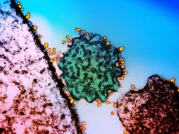 Nipah ვირუსი Nipah ვირუსი