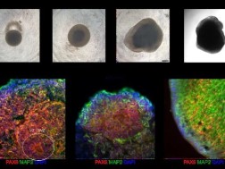ადამიანის ტვინის ქსოვილისგან ფუნქციური კომპიუტერი შექმნეს ადამიანის ტვინის ქსოვილისგან ფუნქციური კომპიუტერი შექმნეს