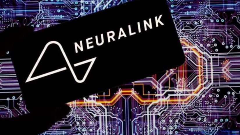 აშშ-ის მთავრობამ Neuralink-ს მეორე მოხალისისთვის ჩიპის ჩანერგვის ნებართვა მისცა