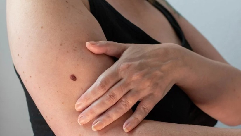 skin