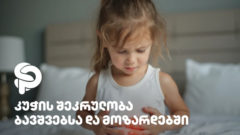 რეკლამა