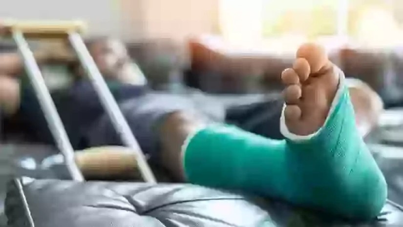 ძვლის მოტეხილობა
