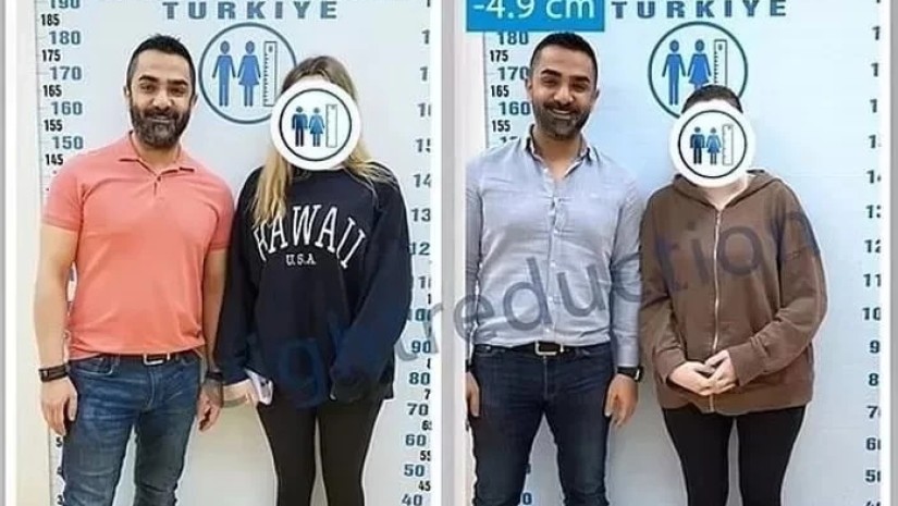 ოპერაცია