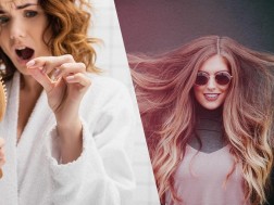 თმის ცვენა