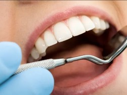 კარიესი