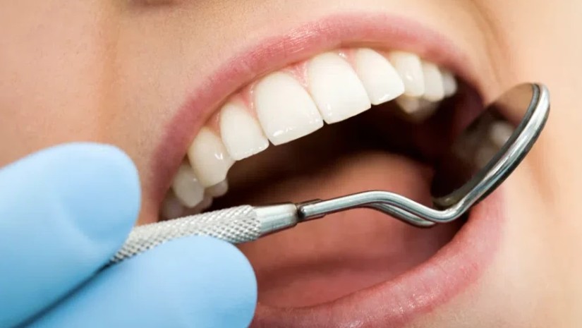 კარიესი