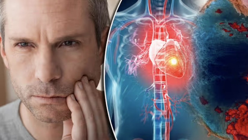 ინფაქრტი