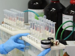 სურსათის ეროვნული სააგენტო