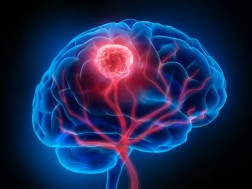 თავის ტვინი თავის ტვინი