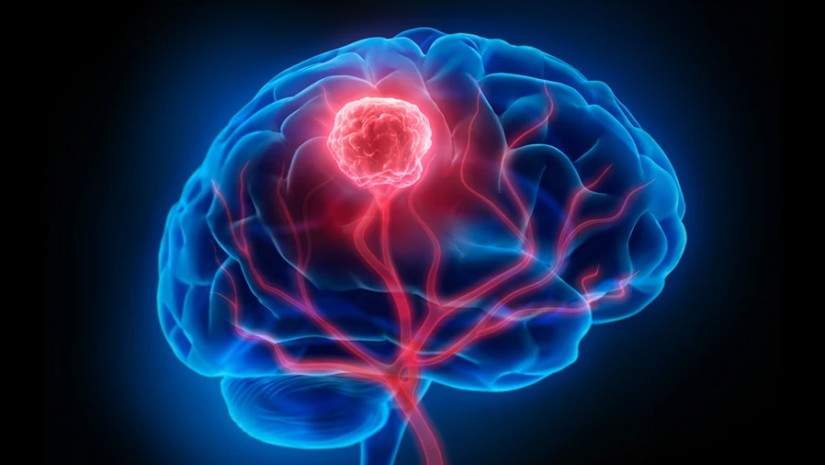 თავის ტვინი