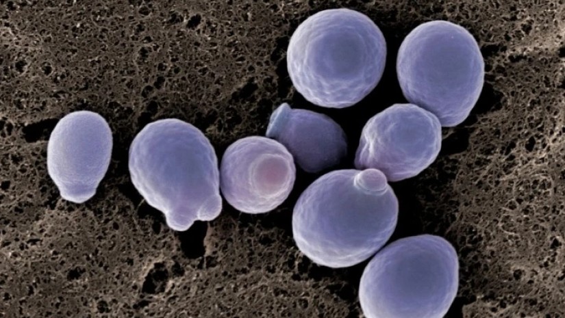 კანდიდოზი