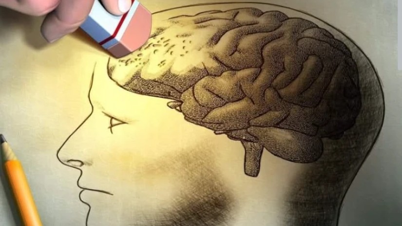 ტვინი განზრახ გვავიწყებინებს რაღაცეებს