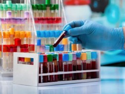 სისხლის ახალი ჯგუფი