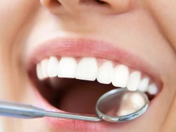 კბილები