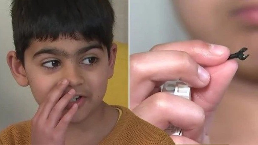 ლეგო ცხვირში