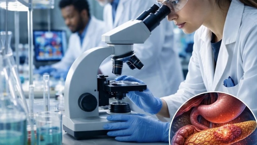 პანკრეასის კიბო