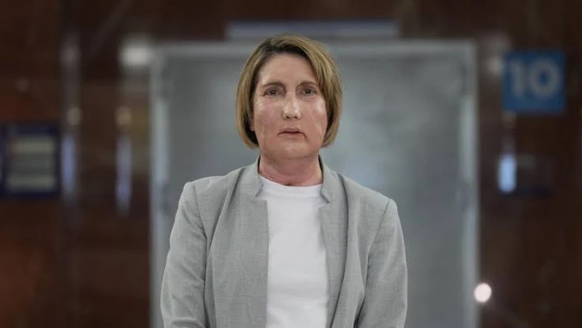 ტრანსპლანტაცია