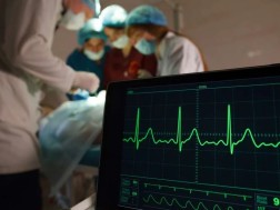 ოპერაცია