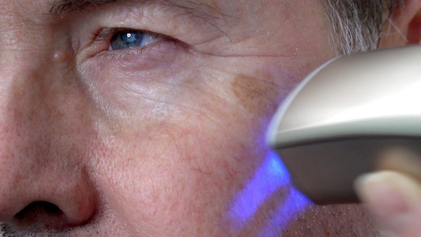 გაახალგაზრდავება