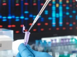 ანალიზი