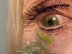 ლინზები