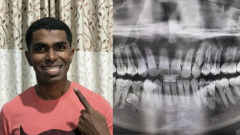 მალაიზიელი კაცი