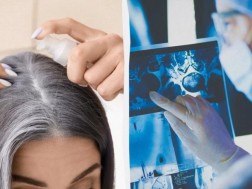 ჭაღარა და კიბო