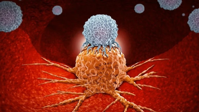 პროსტატის კიბო