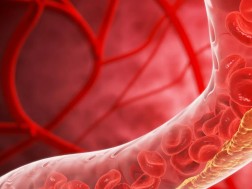 ინსულტი