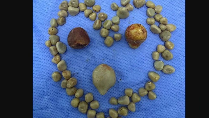 კენჭები