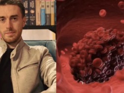 ღოღობერძიე