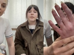 შილაკი