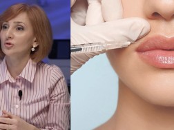 "ფილერის გაკეთების დროს შეიძლება ადამიანი დაბრმავდეს" - დერმატოლოგი ესთეტიკური პროცედურების გართულებებზე საუბრობს