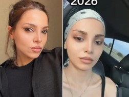ლიკა გაგნიძე